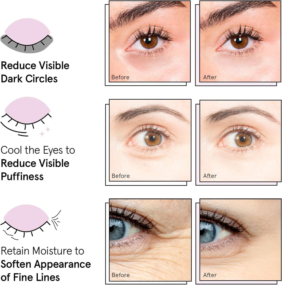 grace & stella Under Eye Patches (12 pairs) Eye Masks for Puffy Eyes and Dark Circles - Valentine Gifts for Women - Gifts for Wife, Bridesmaids, Birthdays, Bachelorette Party, Self Care - Vegan