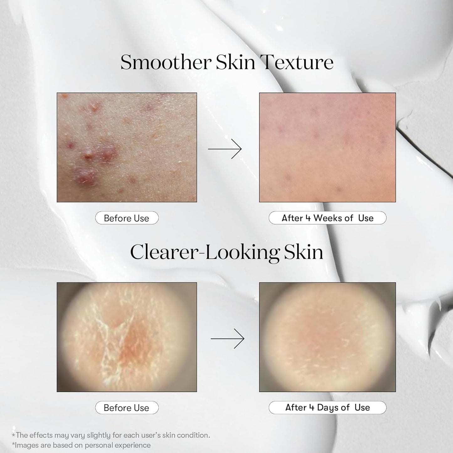 VT COSMETICS CICA Reedle Shot 300, Advanced Night Exosome, Microneedling Serum, Centella Asiatica, Hyaluronic Acid, Propolis, Soft Skin, Regeneration, Glass Skin, Korean Skin Booster 1.69Fl Oz (50ml)