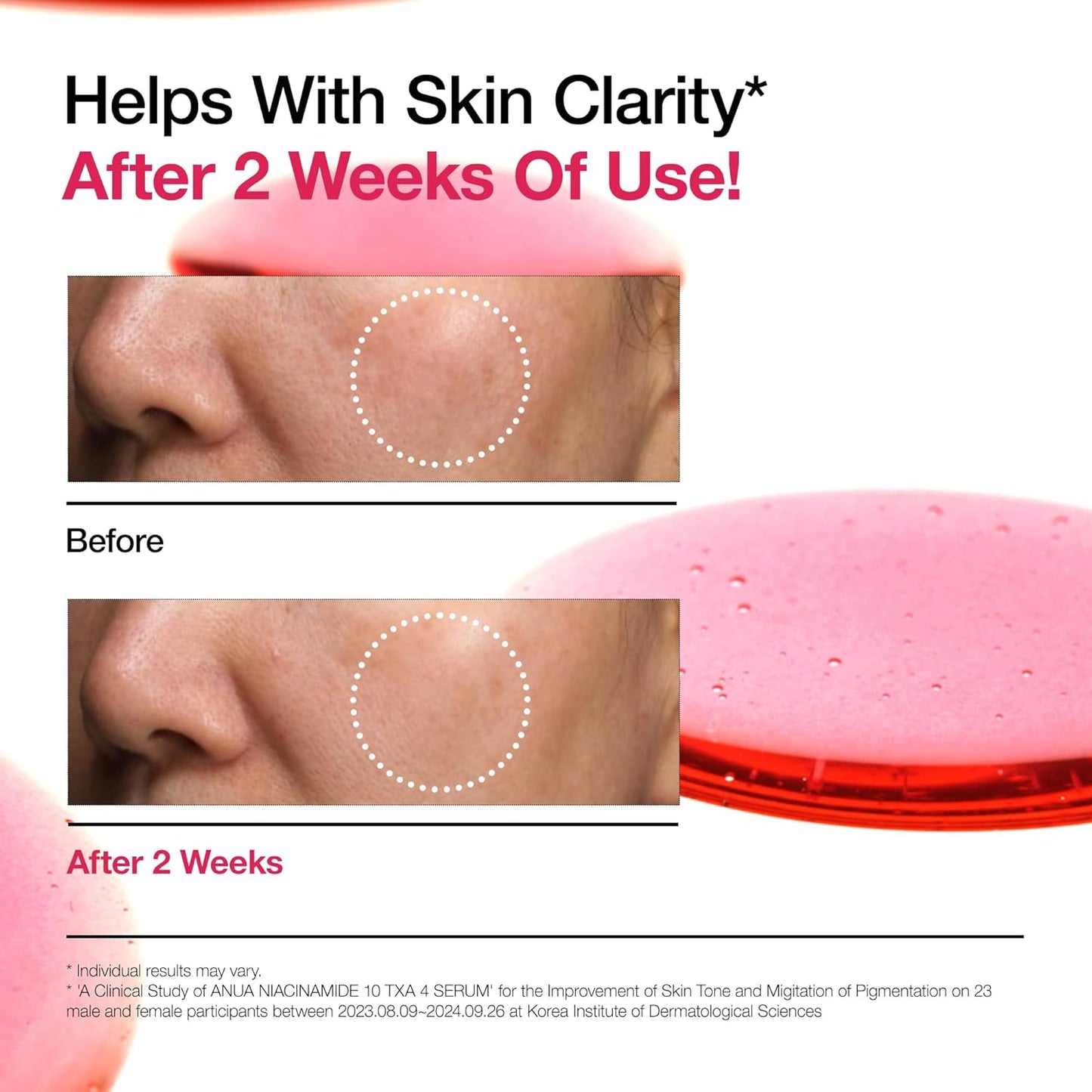 ANUA Niacinamide 10 + TXA 4 Serum, Hyaluronic Acid, Tranexamic acid, Vitamin B12, Facial Serum for Glass Skin, Clarifying, Radiant Complexion with Natural Color, Korean Skin Care (30ml /1.01 fl.oz)