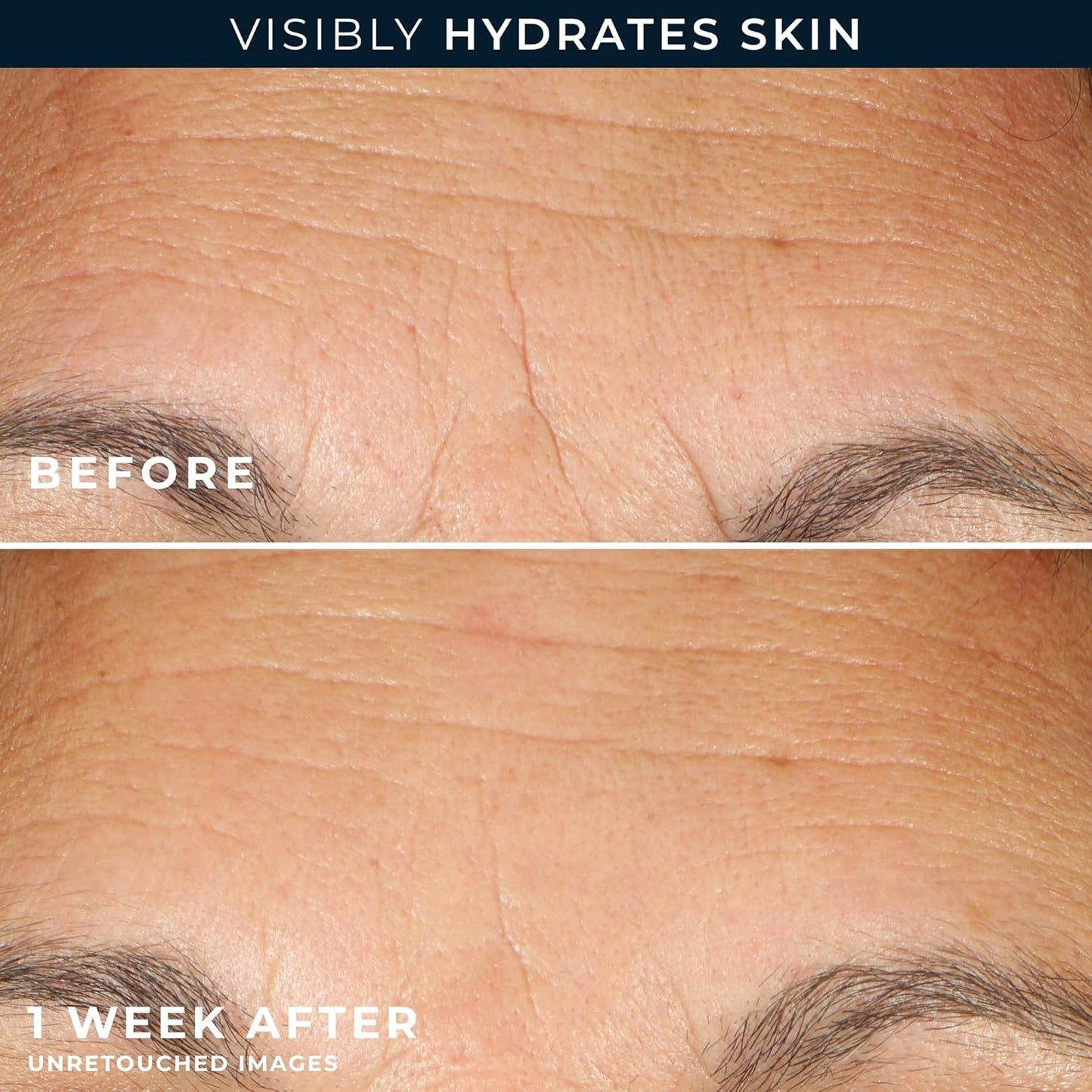 RoC Multi Correxion Hyaluronic Acid Night Serum Capsules (30 CT) for Intense Hydration + RoC Retinol Capsules (7 CT), Anti-Aging Skin Care Wrinkle Treatment for Women and Men