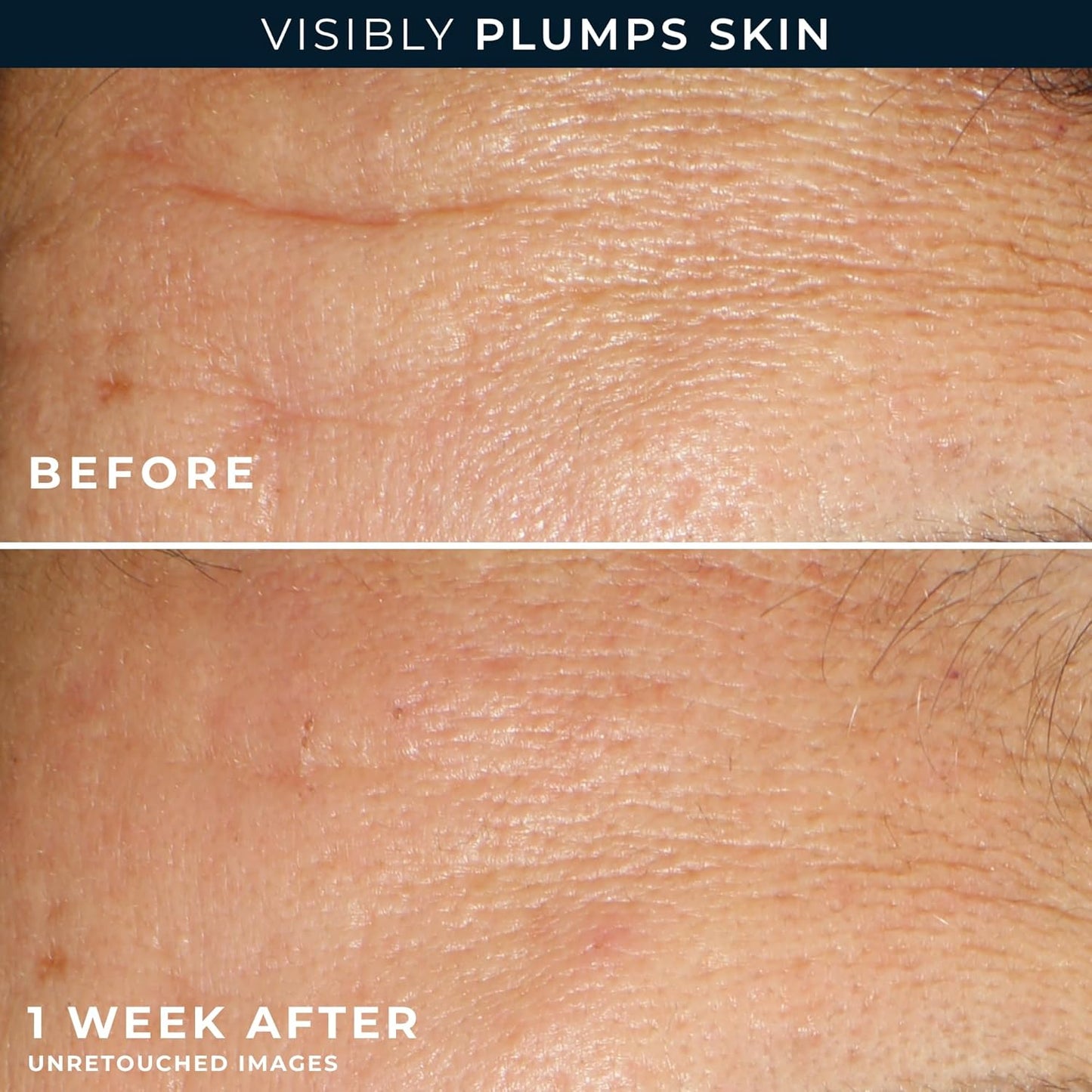 RoC Multi Correxion Hyaluronic Acid Night Serum Capsules (30 CT) for Intense Hydration + RoC Retinol Capsules (7 CT), Anti-Aging Skin Care Wrinkle Treatment for Women and Men