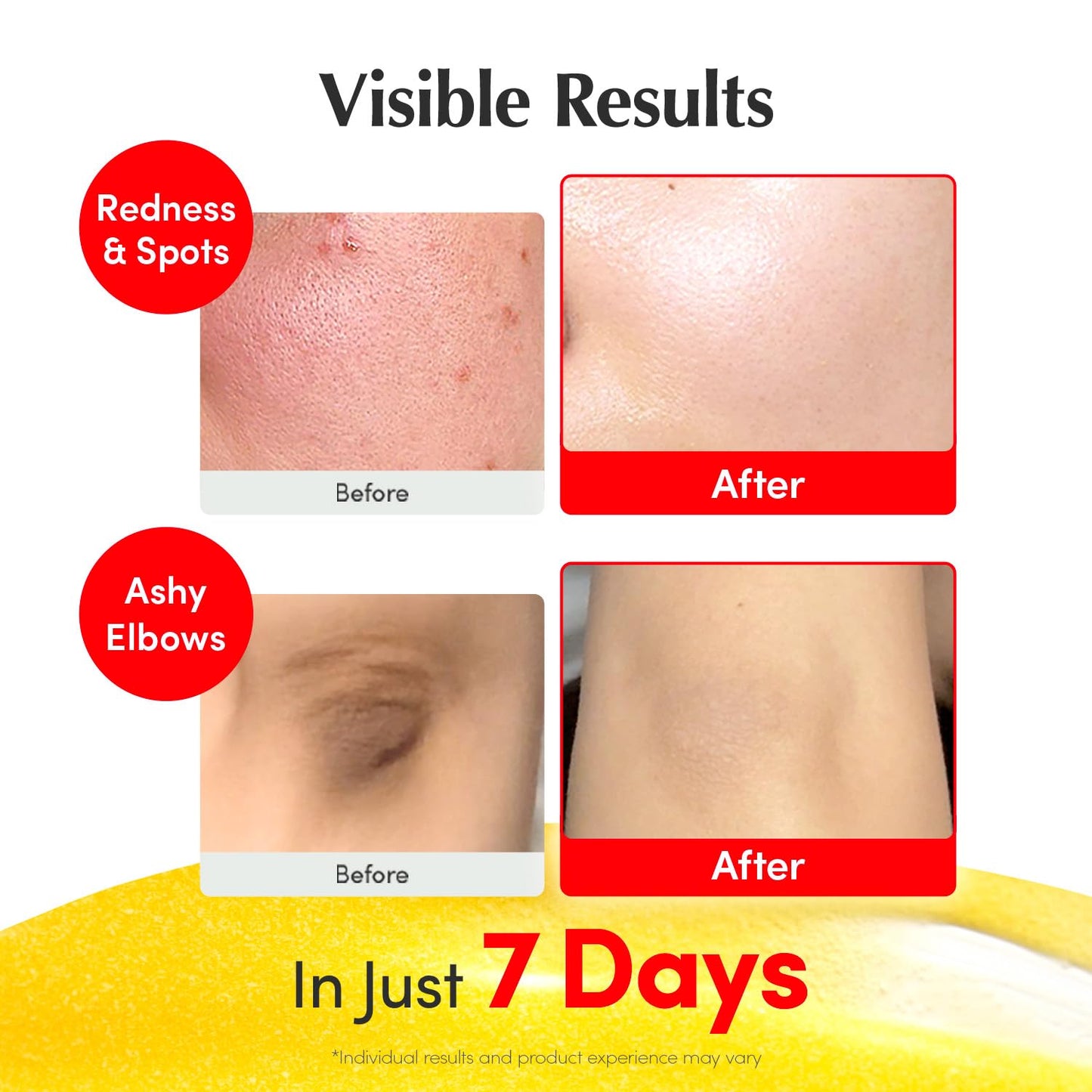Vitamin Illuminating Serum – Brightening Vitamin C Serum with Niacinamide | Strengthens skin barrier | Hydrates using Ceramide and Hyaluronic Acid, 1.01oz / 30ml