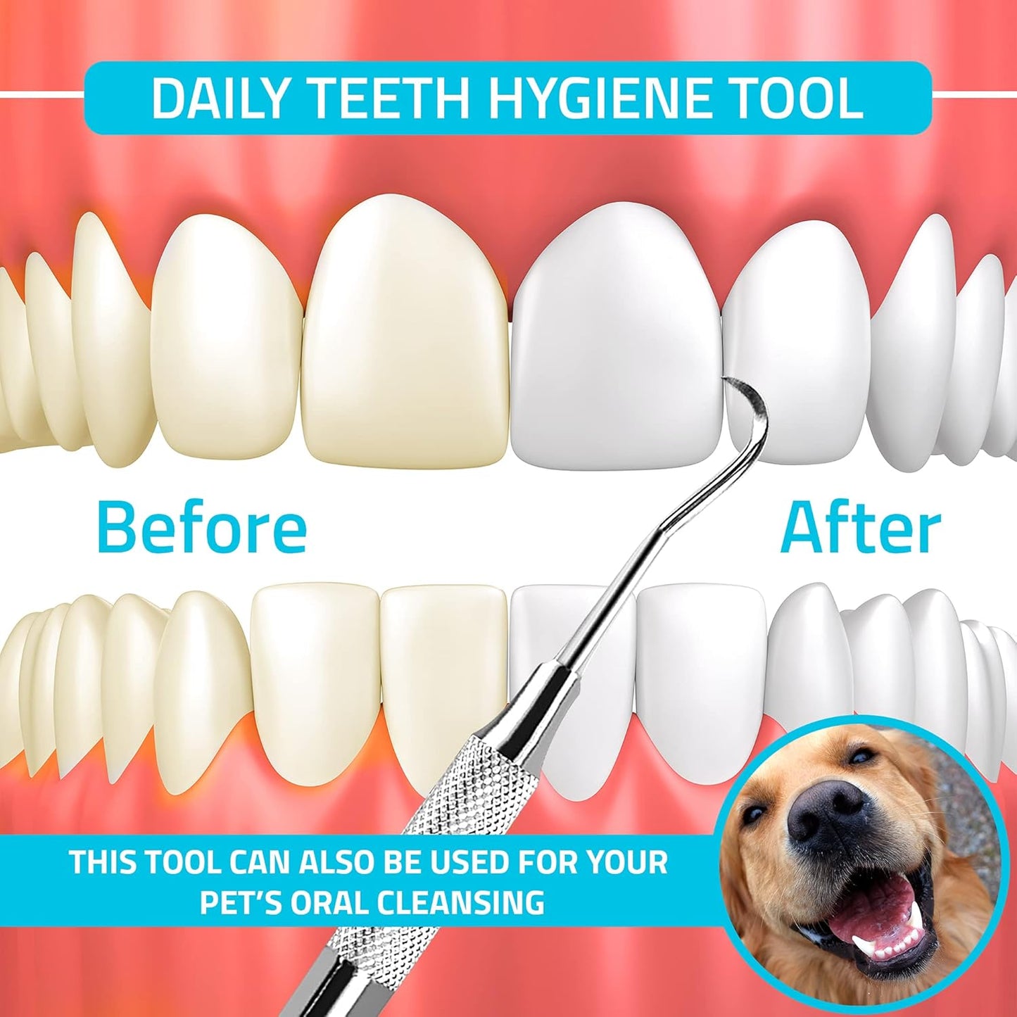 Utopia Care Professional Dental Tartar Scraper Tool, Dental Pick, Double Ended Tartar Remover for Teeth, Plaque Remover, Tooth Scraper, (1, Silver, 6.5 Inch)