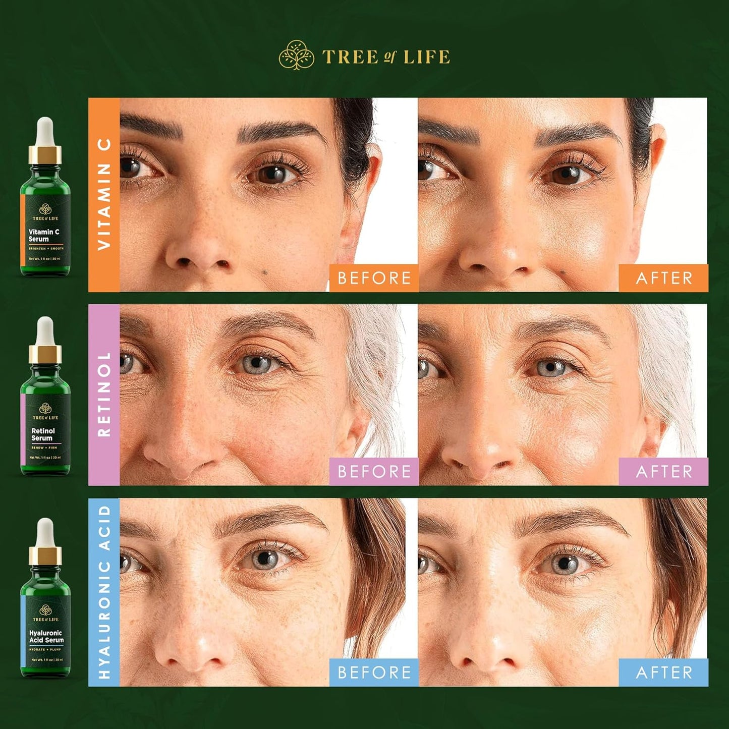 Tree of Life Beauty Facial Skin Care Set, Brightening, Firming, Hydrating, Dry Face, Dermatologist Tested - Trio Power Kit, Vitamin C, Retinol and Hyaluronic Acid, 3 count of 1 Fl Oz
