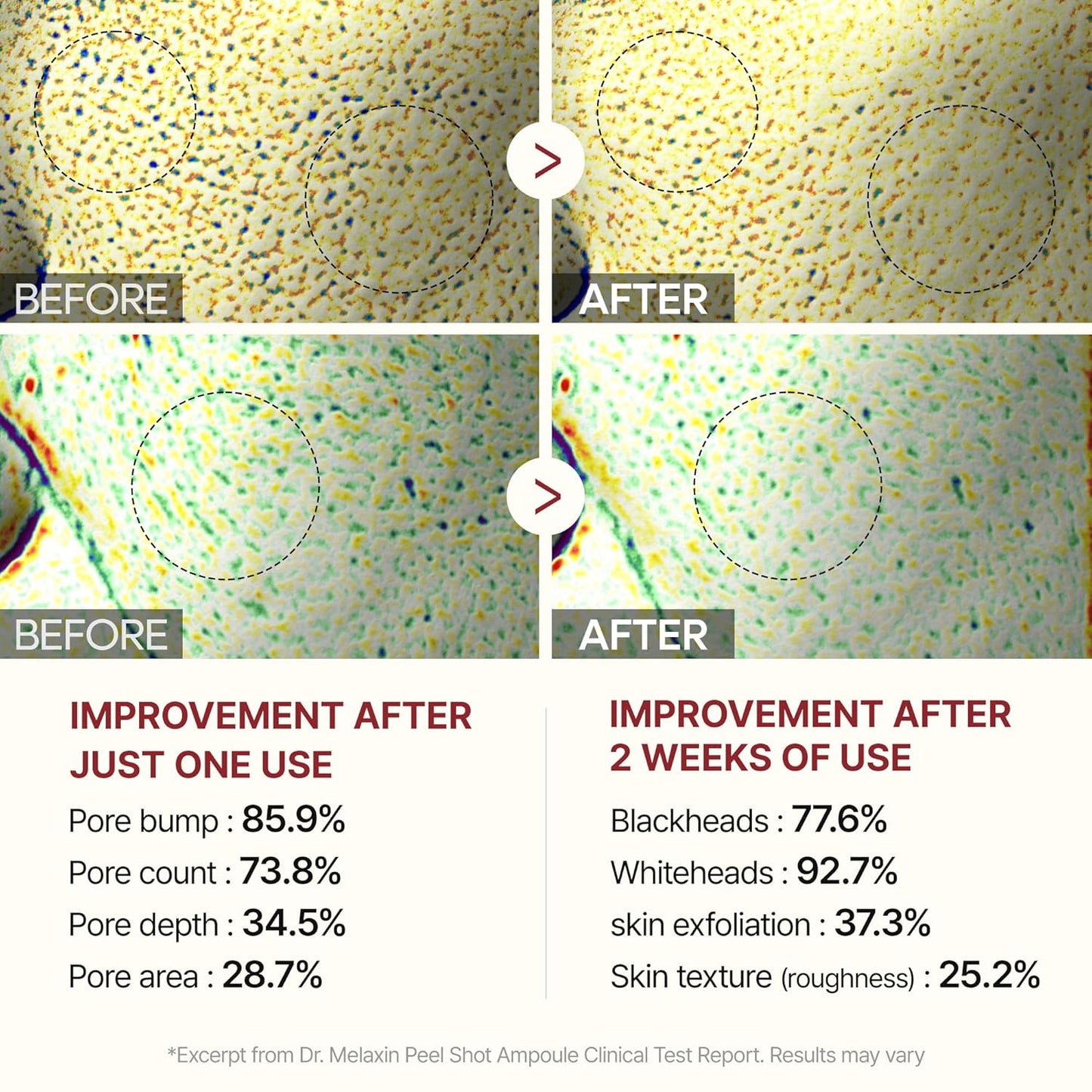 Peel Shot Glow Black Rice Ampoule - Soft Exfoliating Scrub & Blackhead Remover 80ml - Cart Shape